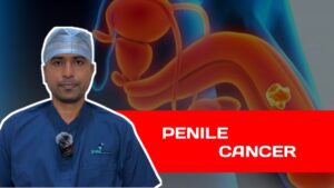 Penile Cancer