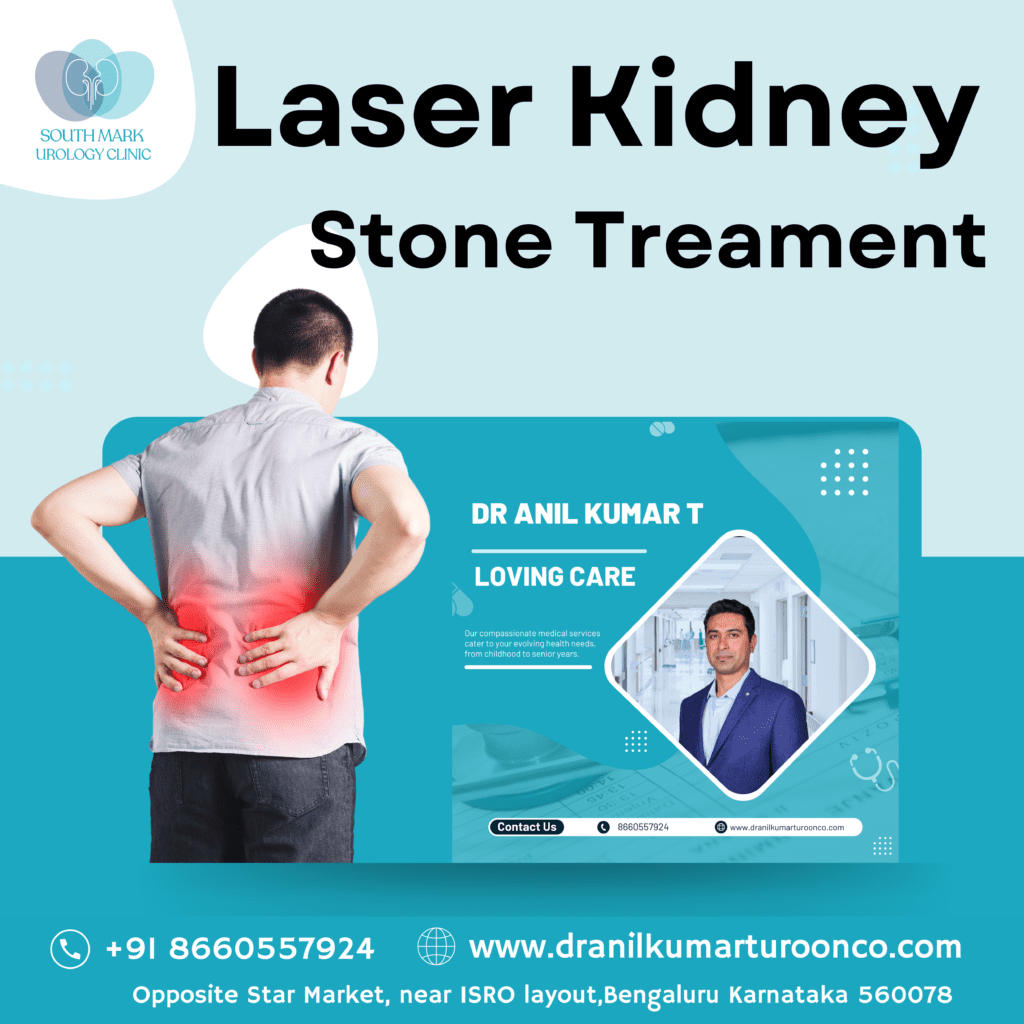 best-laser-kidney-stone-treatment-in-bangalore