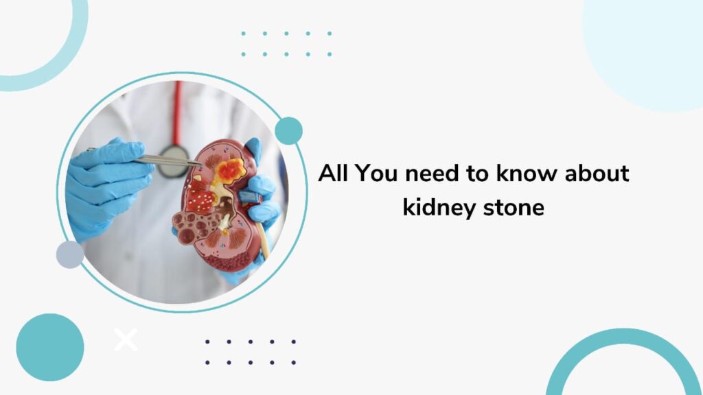 kidney stones