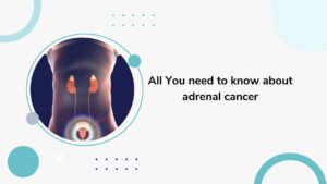 adrenal cancer
