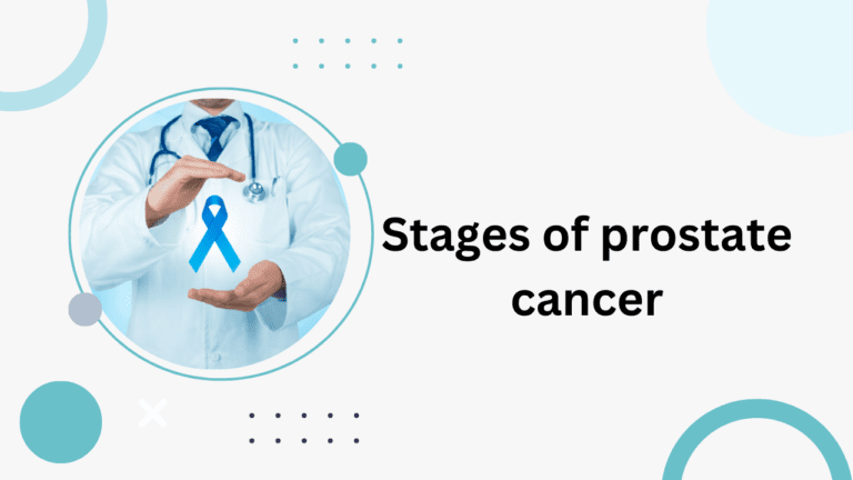 Stages of Prostate Cancer