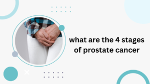 4 stages of prostate cancer