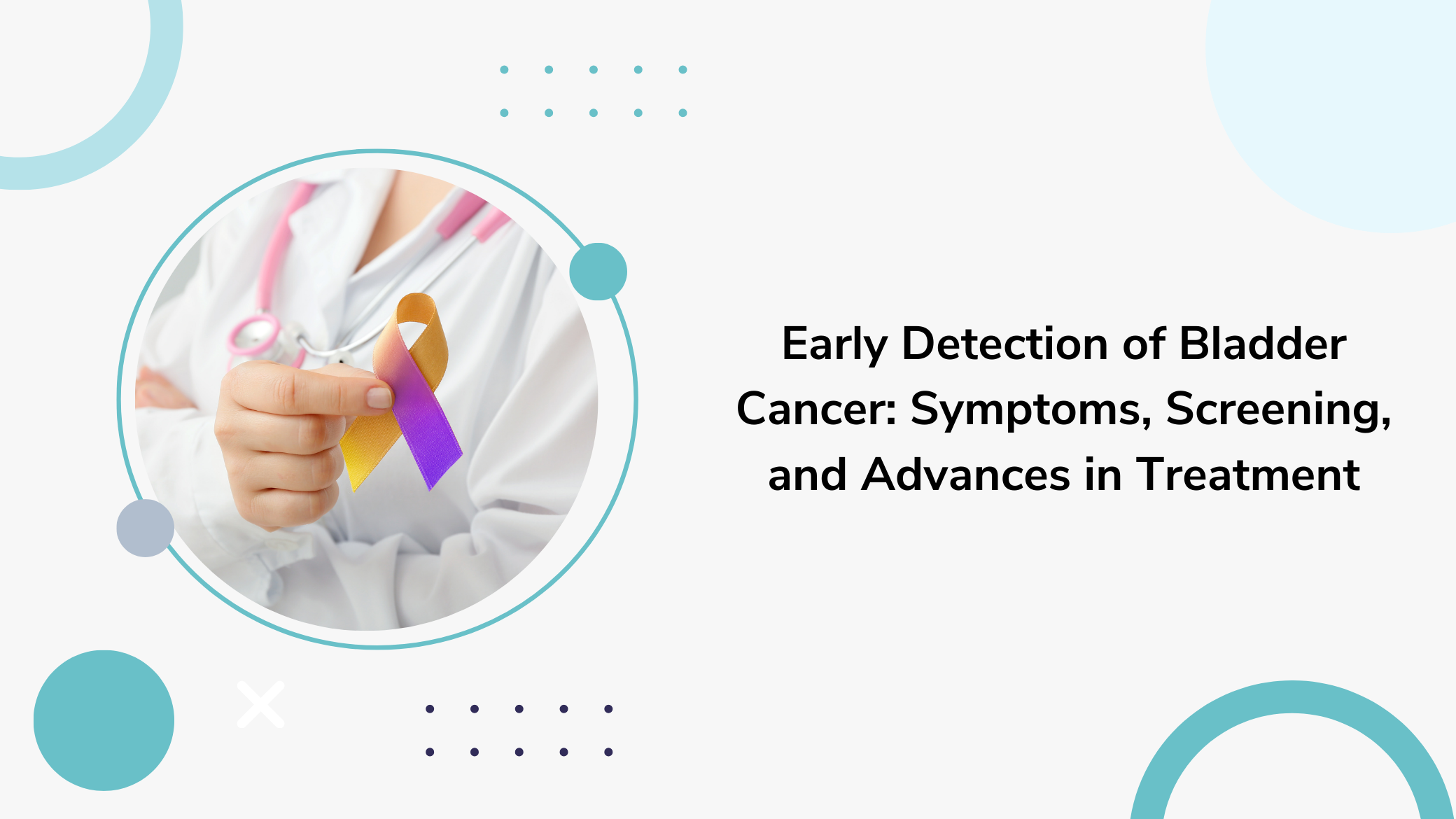 Early Detection of Bladder Cancer: Symptoms, Screening, and Advances in Treatment Bladder cancer is one of the most common cancers, especially in older adults. Early detection is crucial for effective treatment and improved survival rates. Understanding the symptoms, available screening methods, and recent advancements in treatment can empower individuals to seek timely medical attention and explore the best possible care options. Symptoms of Bladder Cancer Early detection of bladder cancer often hinges on recognizing the warning signs. Common symptoms include: Hematuria (Blood in Urine): This is the most common symptom. The blood might be visible (gross hematuria) or detectable only through a urine test (microscopic hematuria). Changes in Urination: Frequent urination Pain or burning during urination Feeling the need to urinate without results Weak urine stream or interrupted flow Pelvic and Back Pain: Persistent pain in the lower back or pelvis can indicate advanced stages of bladder cancer. Unexplained Weight Loss and Fatigue: These symptoms are more general but can be associated with cancer. If you experience any of these symptoms, it’s essential to consult a healthcare professional promptly. Screening for Bladder Cancer Early-stage bladder cancer often presents with few symptoms, making regular screening crucial for high-risk individuals. Screening methods include: Urinalysis: This basic test checks for blood in the urine. While not specific to bladder cancer, it can indicate the need for further testing. Urine Cytology: Examining urine under a microscope to look for cancerous cells can provide early detection, particularly in high-risk individuals. Cystoscopy: This procedure involves inserting a thin tube with a camera into the bladder through the urethra. It allows direct visualization of the bladder lining and any abnormal growths. Imaging Tests: Tests like CT urograms and MRIs can help identify tumors and determine their stage and spread. Biomarker Tests: Recent advances have led to the development of tests that detect specific substances released by cancer cells into the urine. These biomarkers can help in early detection and monitoring of bladder cancer. Advances in Treatment Recent years have seen significant progress in bladder cancer treatment, improving outcomes and quality of life for patients. Key advancements include: Immunotherapy: This treatment leverages the body’s immune system to target and destroy cancer cells. Drugs like checkpoint inhibitors (e.g., pembrolizumab, atezolizumab) have shown promise in treating advanced bladder cancer. Targeted Therapy: These drugs target specific molecules involved in cancer growth and progression. Examples include erdafitinib, which targets FGFR genetic alterations in bladder cancer cells. Enhanced Surgical Techniques: Minimally invasive surgical options, such as robotic-assisted cystectomy, offer quicker recovery times and fewer complications compared to traditional surgery. Intravesical Therapy: For early-stage bladder cancer, treatments such as Bacillus Calmette-Guérin (BCG) and mitomycin C can be directly instilled into the bladder, targeting cancer cells while minimizing systemic side effects. Photodynamic Therapy (PDT): This treatment involves using light-sensitive drugs and a specific wavelength of light to kill cancer cells. PDT can be effective for certain types of bladder cancer. Gene Therapy and Personalized Medicine: Ongoing research is exploring ways to use genetic information to tailor treatments to individual patients, potentially increasing the effectiveness of therapy and reducing side effects. Conclusion Early detection and treatment of bladder cancer are critical for improving patient outcomes. Awareness of the symptoms, regular screening for high-risk individuals, and staying informed about the latest treatment advances can make a significant difference. If you experience any symptoms of bladder cancer, seek medical advice promptly. With continued research and advancements, the future of bladder cancer treatment looks promising, offering hope for better management and improved survival rates.