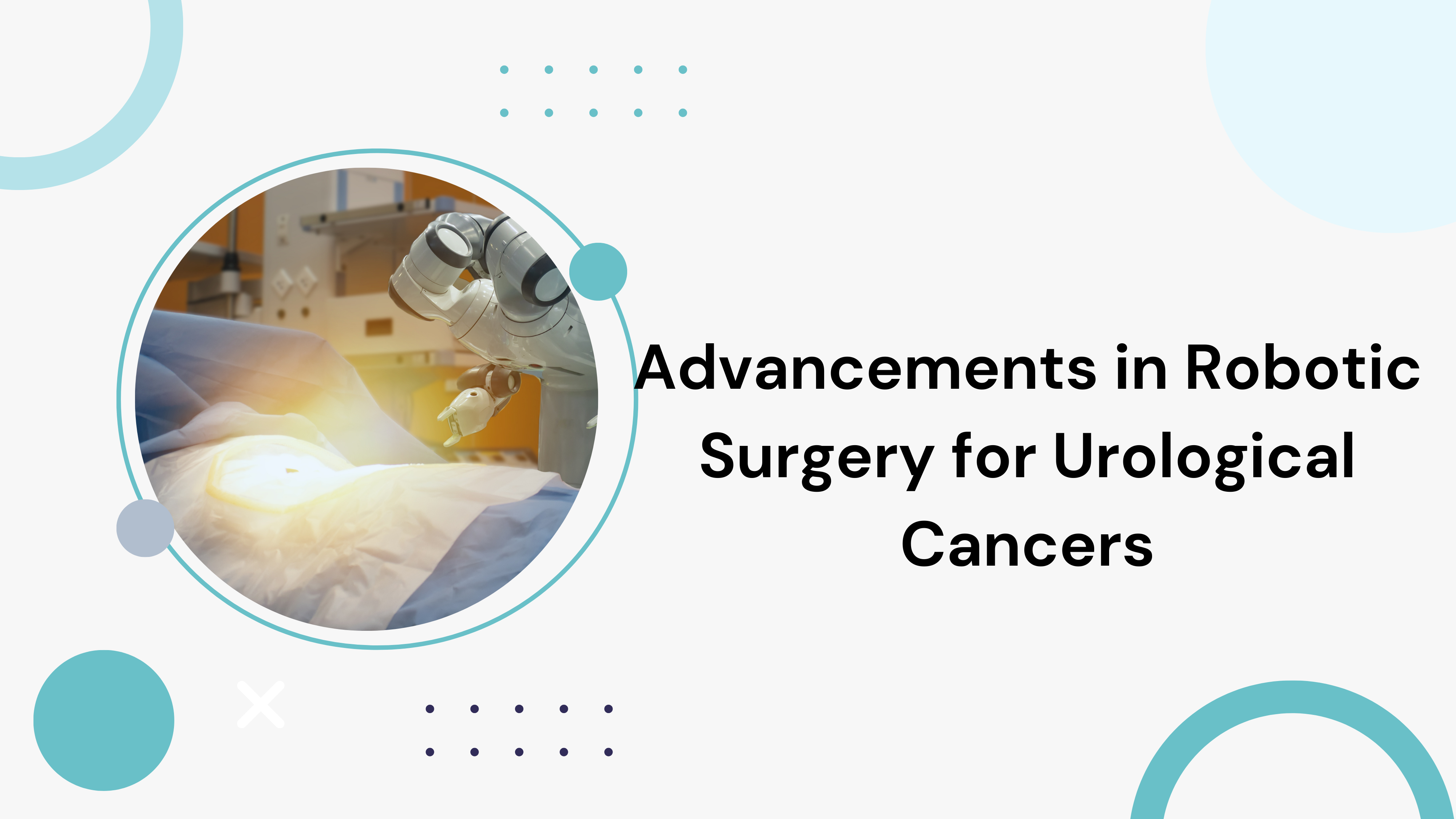 Advancements in Robotic Surgery for Urological Cancers