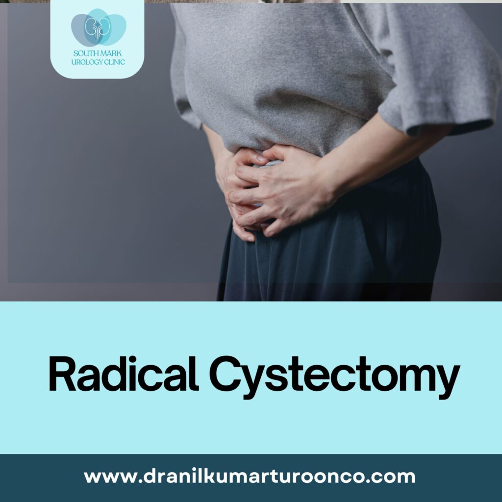 Radical Cystectomy